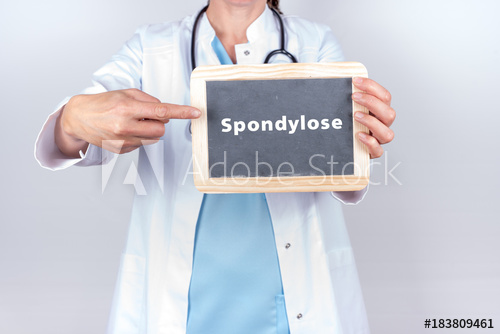 Diagnose Spondylose Diagnose Spondylose
